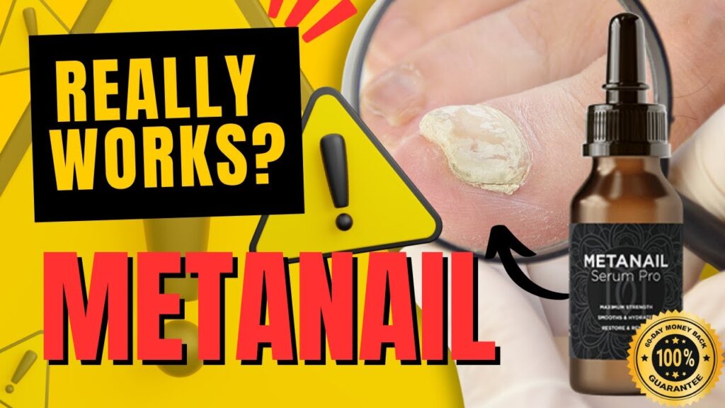Metanail Complex Review